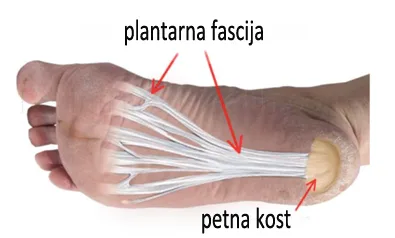 plantarna fascija